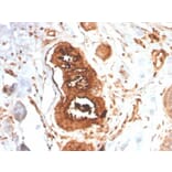 Immunohistochemistry - Anti-Mammaglobin A Antibody [MGB/4058R] (A249328) - Antibodies.com