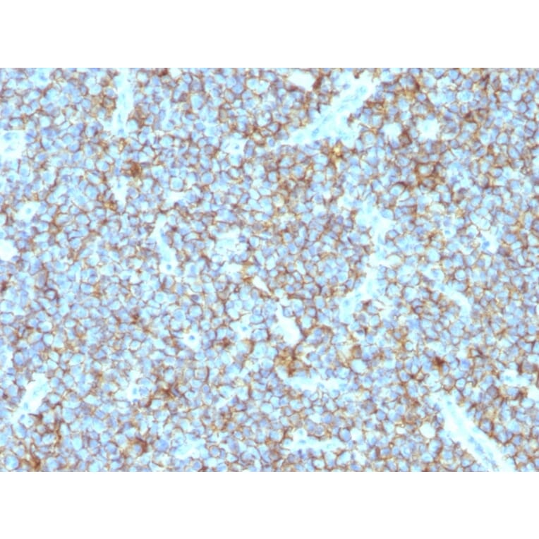 Immunohistochemistry - Anti-CD99 Antibody [MIC2/877] (A249329) - Antibodies.com
