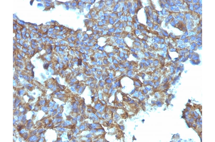 Immunohistochemistry - Anti-CD99 Antibody [MIC2/877] (A249330) - Antibodies.com