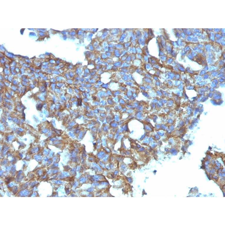 Immunohistochemistry - Anti-CD99 Antibody [MIC2/877] (A249330) - Antibodies.com