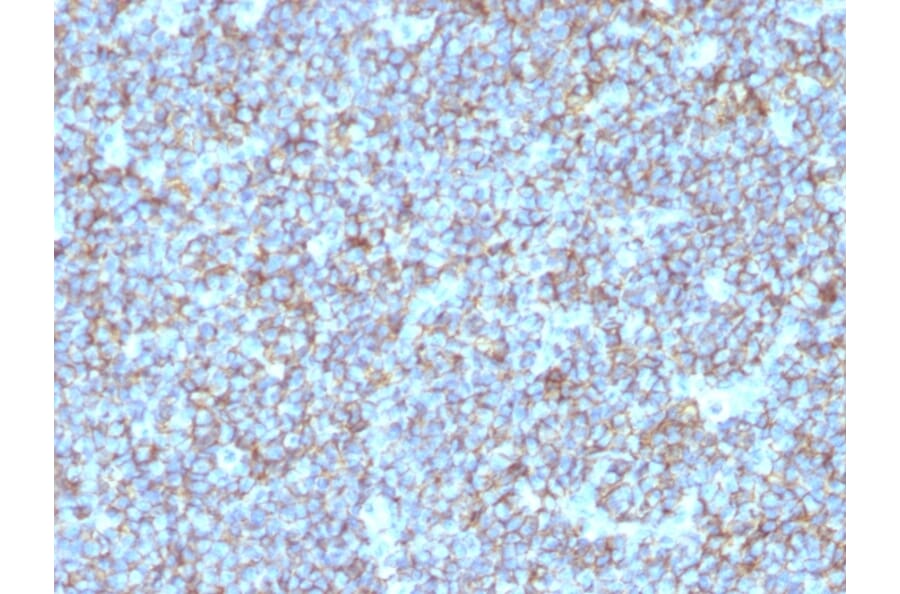 Immunohistochemistry - Anti-CD99 Antibody [SPM596] (A249330) - Antibodies.com