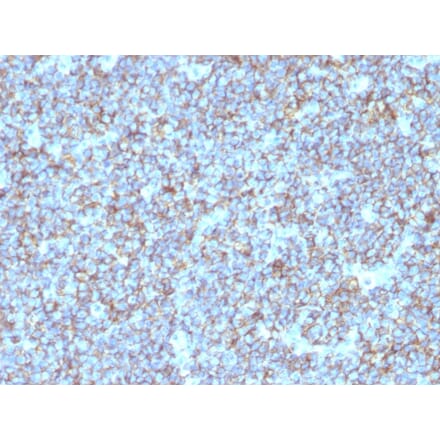Immunohistochemistry - Anti-CD99 Antibody [SPM596] (A249330) - Antibodies.com