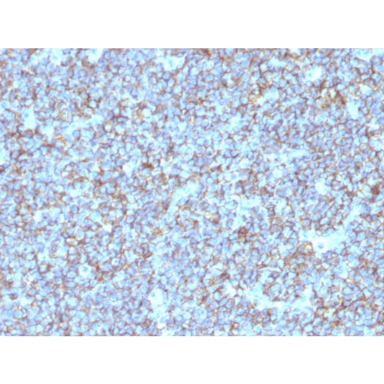 Immunohistochemistry - Anti-CD99 Antibody [SPM596] (A249330) - Antibodies.com
