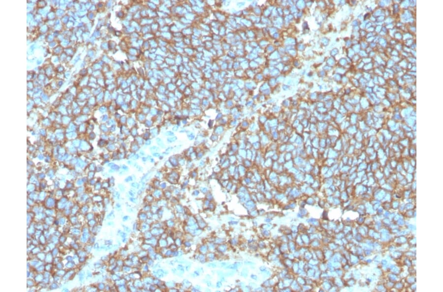 Immunohistochemistry - Anti-CD99 Antibody [rMIC2/3317] (A249333) - Antibodies.com