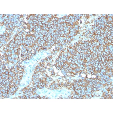 Immunohistochemistry - Anti-CD99 Antibody [rMIC2/3317] (A249333) - Antibodies.com