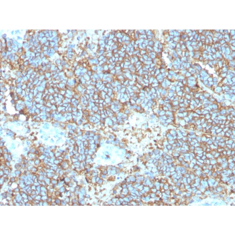 Immunohistochemistry - Anti-CD99 Antibody [rMIC2/3317] (A249332) - Antibodies.com