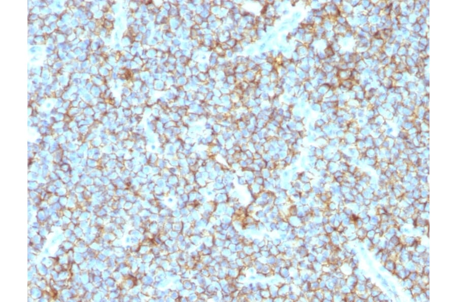 Immunohistochemistry - Anti-CD99 Antibody [MIC2/1495R] (A249333) - Antibodies.com