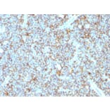 Immunohistochemistry - Anti-CD99 Antibody [MIC2/1495R] (A249333) - Antibodies.com