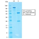 SDS-PAGE - Anti-CD99 Antibody [MIC2/1495R] (A249334) - Antibodies.com