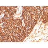 Immunohistochemistry - Anti-CD99 Antibody [MIC2/3478R] (A249335) - Antibodies.com