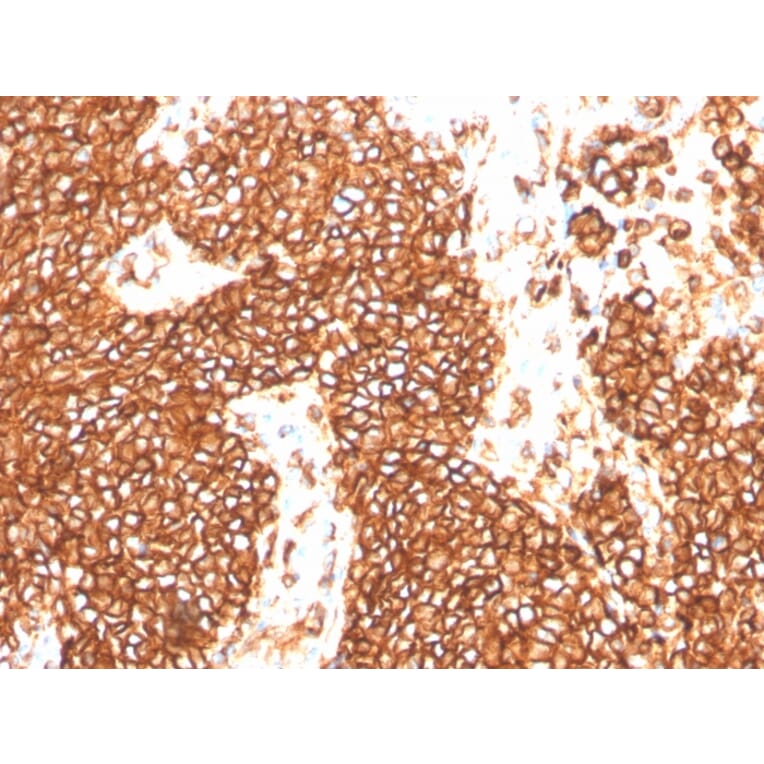 Immunohistochemistry - Anti-CD99 Antibody [MIC2/3478R] (A249334) - Antibodies.com