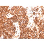 Immunohistochemistry - Anti-CD99 Antibody [MIC2/3478R] (A249334) - Antibodies.com