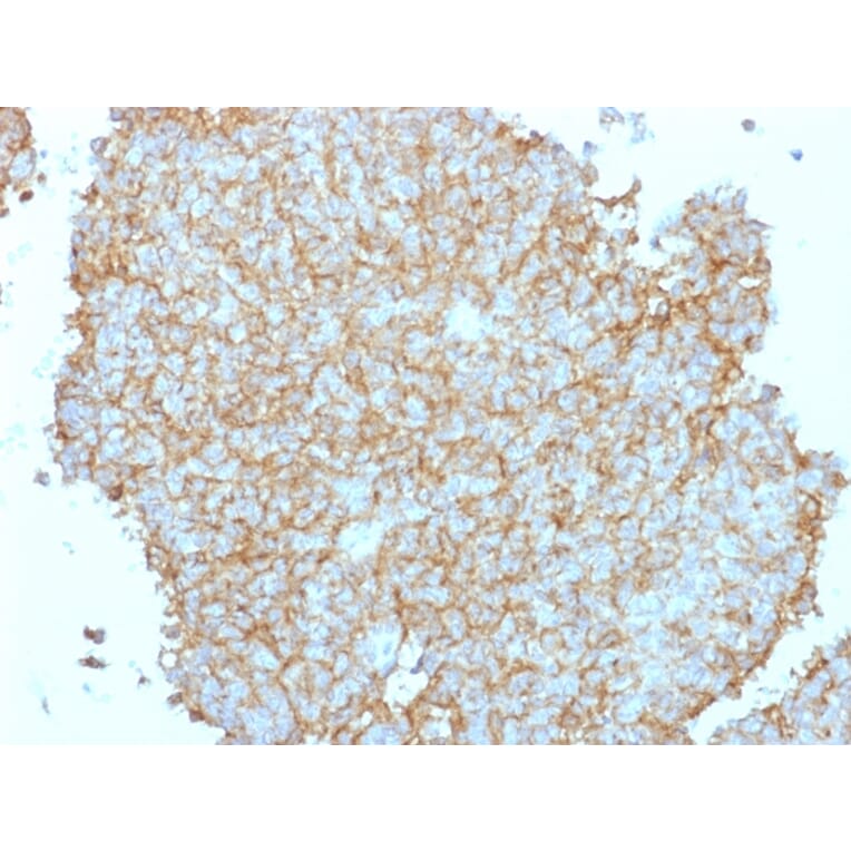 Immunohistochemistry - Anti-CD99 Antibody (A249335) - Antibodies.com