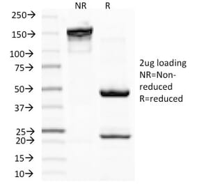 SDS-PAGE - Anti-MiTF Antibody [D5] (A249337) - Antibodies.com