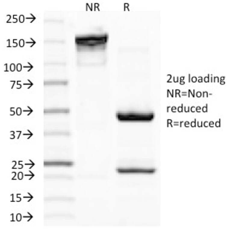 SDS-PAGE - Anti-MiTF Antibody [D5] (A249337) - Antibodies.com