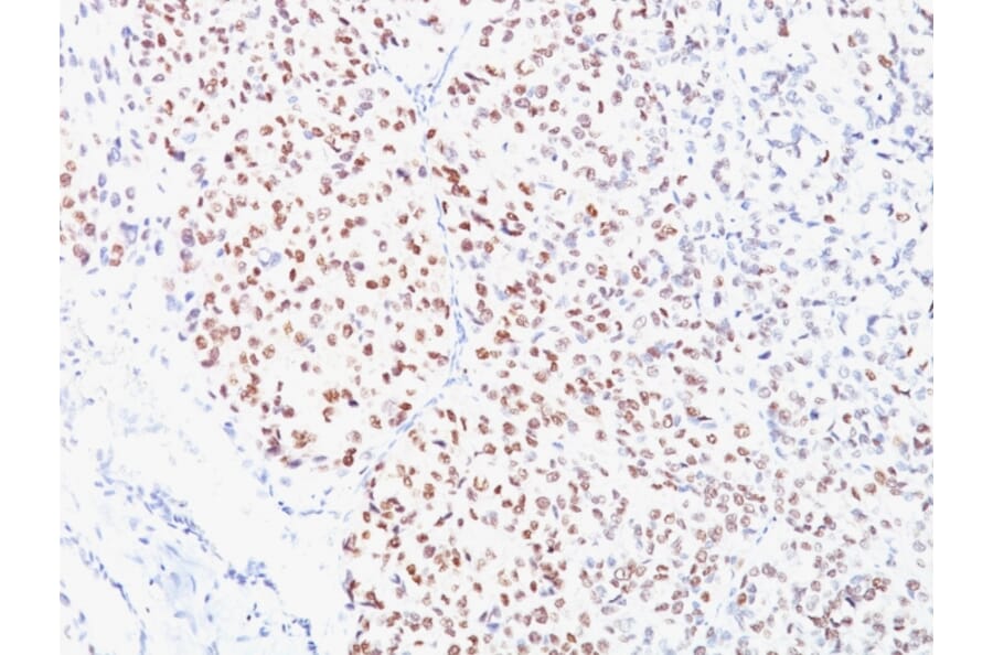 Immunohistochemistry - Anti-MiTF Antibody [D5] (A249336) - Antibodies.com