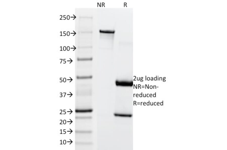 SDS-PAGE - Anti-MiTF Antibody [SPM290] (A249338) - Antibodies.com