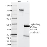 SDS-PAGE - Anti-MiTF Antibody [SPM290] (A249338) - Antibodies.com