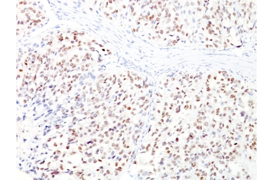 Immunohistochemistry - Anti-MiTF Antibody [D5 + MITF/915] (A249339) - Antibodies.com