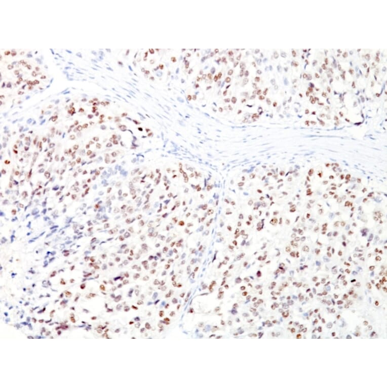 Immunohistochemistry - Anti-MiTF Antibody [D5 + MITF/915] (A249339) - Antibodies.com