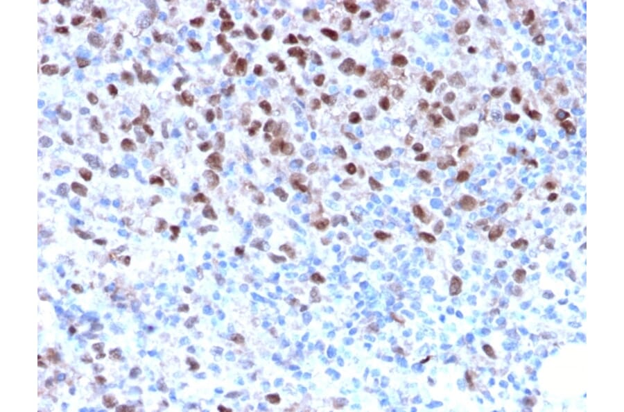 Immunohistochemistry - Anti-MiTF Antibody [MITF/2987R] (A249341) - Antibodies.com