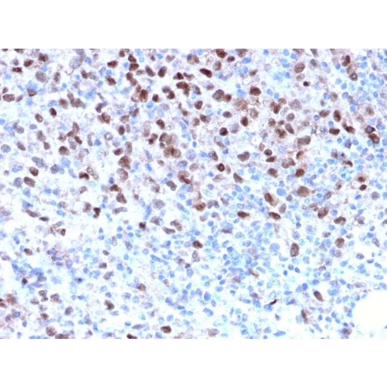 Immunohistochemistry - Anti-MiTF Antibody [MITF/2987R] (A249341) - Antibodies.com