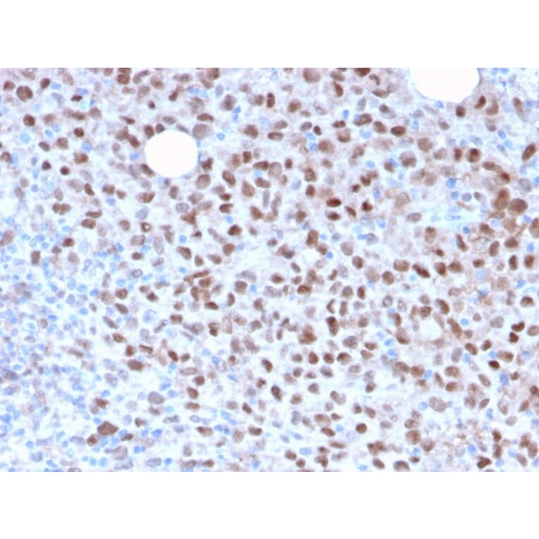Immunohistochemistry - Anti-MiTF Antibody [MITF/2987R] (A249340) - Antibodies.com