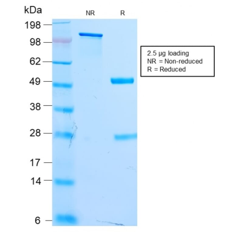 SDS-PAGE - Anti-MiTF Antibody [MITF/2987R] (A249341) - Antibodies.com