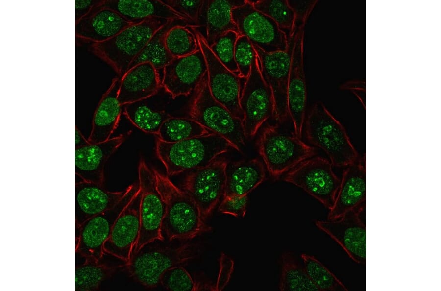 Immunofluorescence - Anti-Ki67 Antibody [MKI67/2461] (A249342) - Antibodies.com