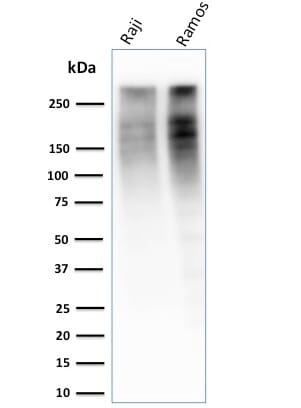 Anti-Ki67 Antibody [MKI67/2461] (A249342) | Antibodies.com