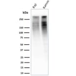 Western Blot - Anti-Ki67 Antibody [MKI67/2461] (A249342) - Antibodies.com