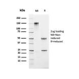 SDS-PAGE - Anti-Ki67 Antibody [MKI67/2461] (A249342) - Antibodies.com