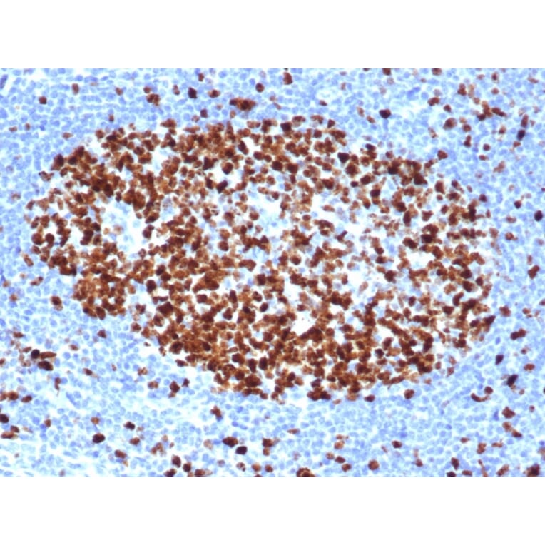 Immunohistochemistry - Anti-Ki67 Antibody [rMKI67/6499] (A249342) - Antibodies.com