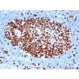 Immunohistochemistry - Anti-Ki67 Antibody [rMKI67/6499] (A249342) - Antibodies.com