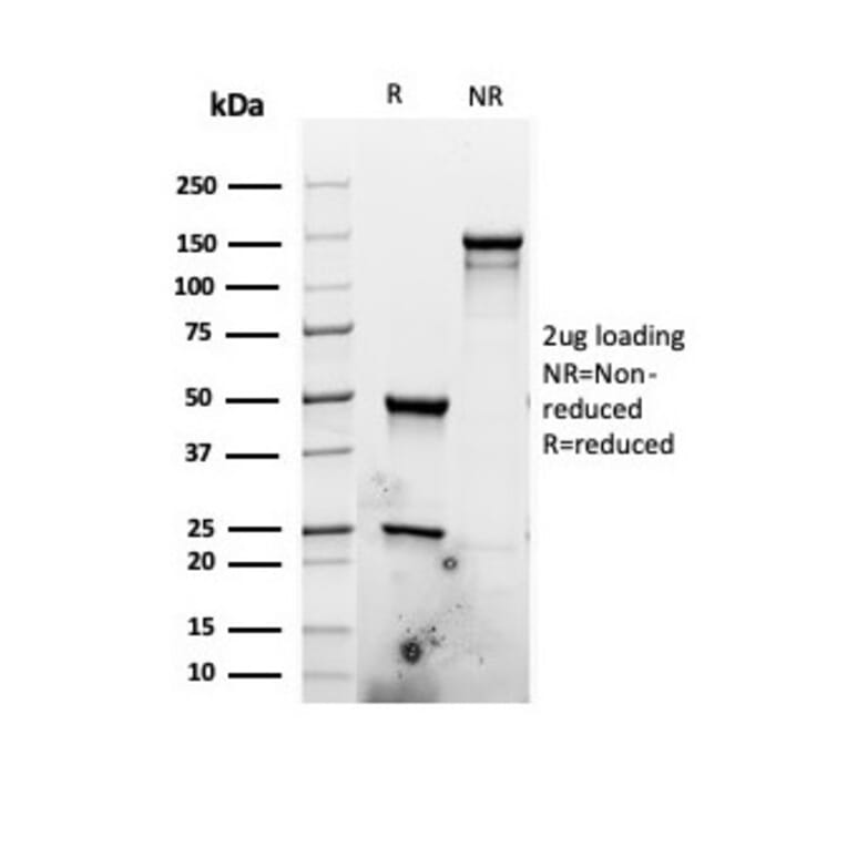 SDS-PAGE - Anti-Ki67 Antibody [rMKI67/6499] (A249343) - Antibodies.com