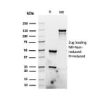 SDS-PAGE - Anti-Ki67 Antibody [rMKI67/6499] (A249343) - Antibodies.com