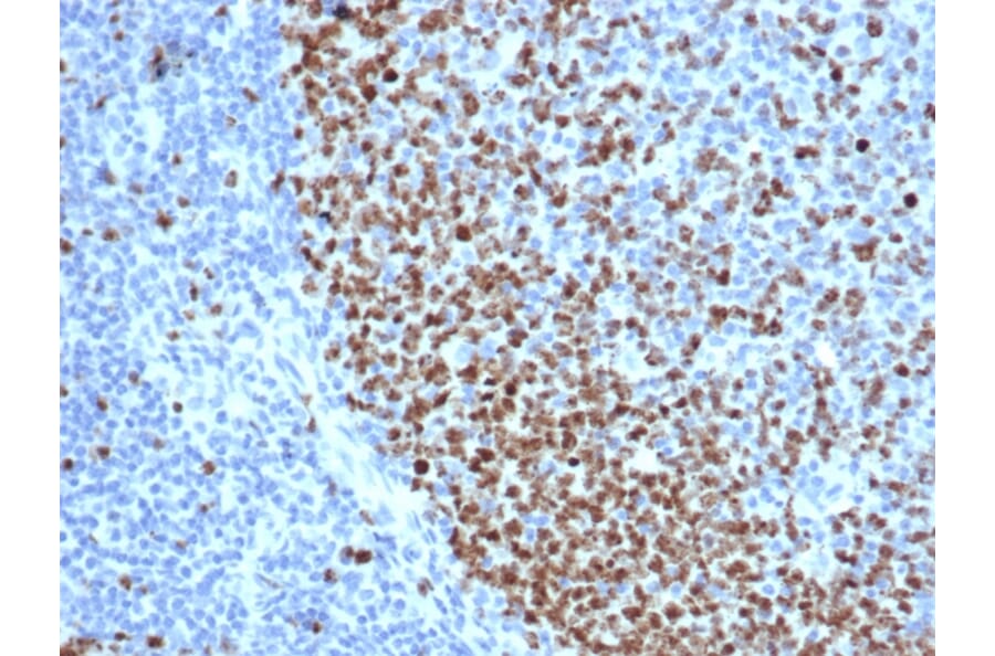 Immunohistochemistry - Anti-Ki67 Antibody [rMKI67/6615] (A249344) - Antibodies.com