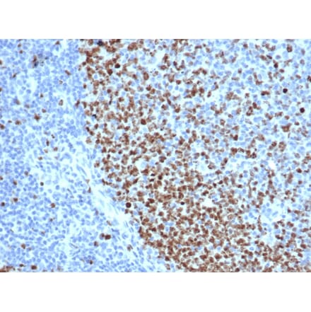 Immunohistochemistry - Anti-Ki67 Antibody [rMKI67/6615] (A249344) - Antibodies.com