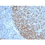 Immunohistochemistry - Anti-Ki67 Antibody [rMKI67/6615] (A249344) - Antibodies.com