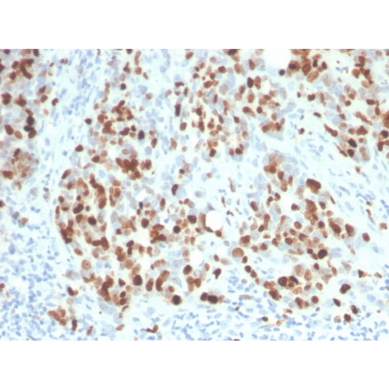 Immunohistochemistry - Anti-Ki67 Antibody [rMKI67/6615] (A249343) - Antibodies.com