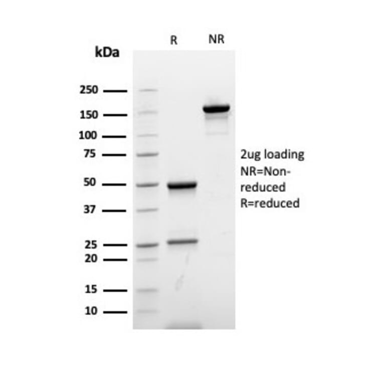 SDS-PAGE - Anti-Ki67 Antibody [rMKI67/6615] (A249344) - Antibodies.com