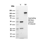 SDS-PAGE - Anti-Ki67 Antibody [rMKI67/6615] (A249344) - Antibodies.com