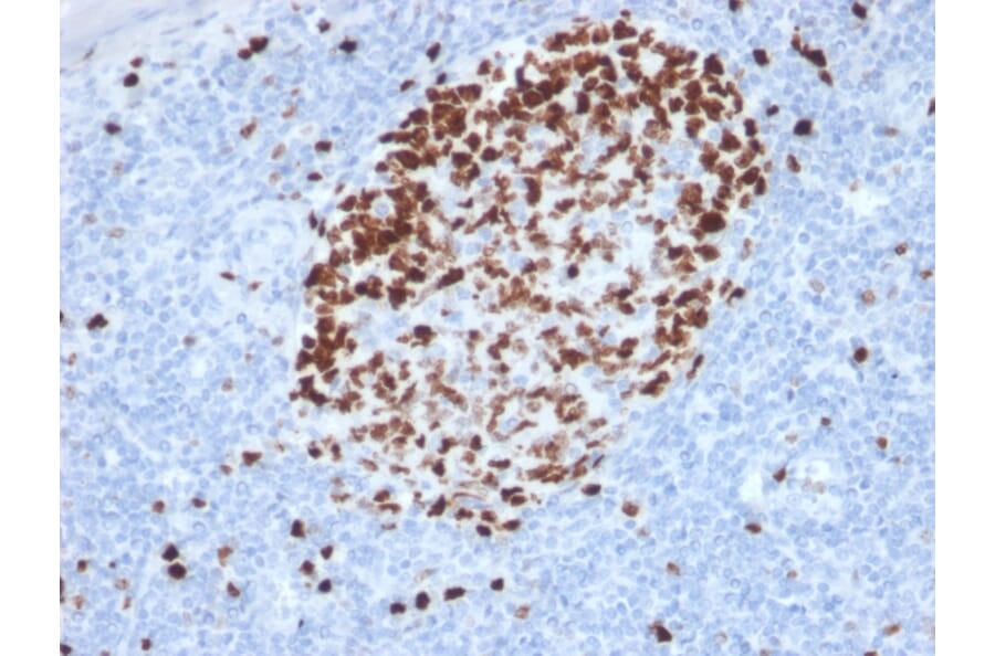 Immunohistochemistry - Anti-Ki67 Antibody [MKI67/2462] (A249345) - Antibodies.com