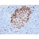 Immunohistochemistry - Anti-Ki67 Antibody [MKI67/2462] (A249345) - Antibodies.com