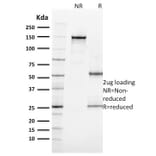 SDS-PAGE - Anti-Ki67 Antibody [MKI67/2462] (A249345) - Antibodies.com