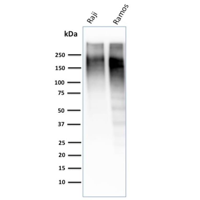 Anti Ki67 Antibody Mki67 2462