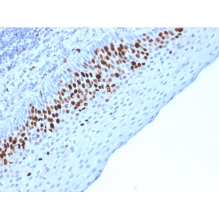 Immunohistochemistry - Anti-Ki67 Antibody [MKI67/2463] (A249346) - Antibodies.com