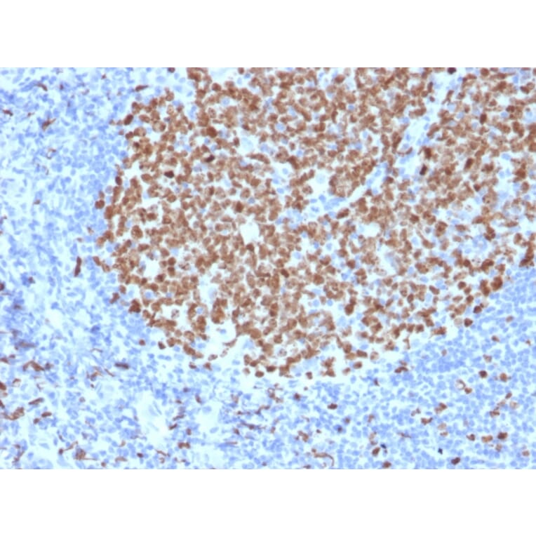 Immunohistochemistry - Anti-Ki67 Antibody [MKI67/2463] (A249346) - Antibodies.com