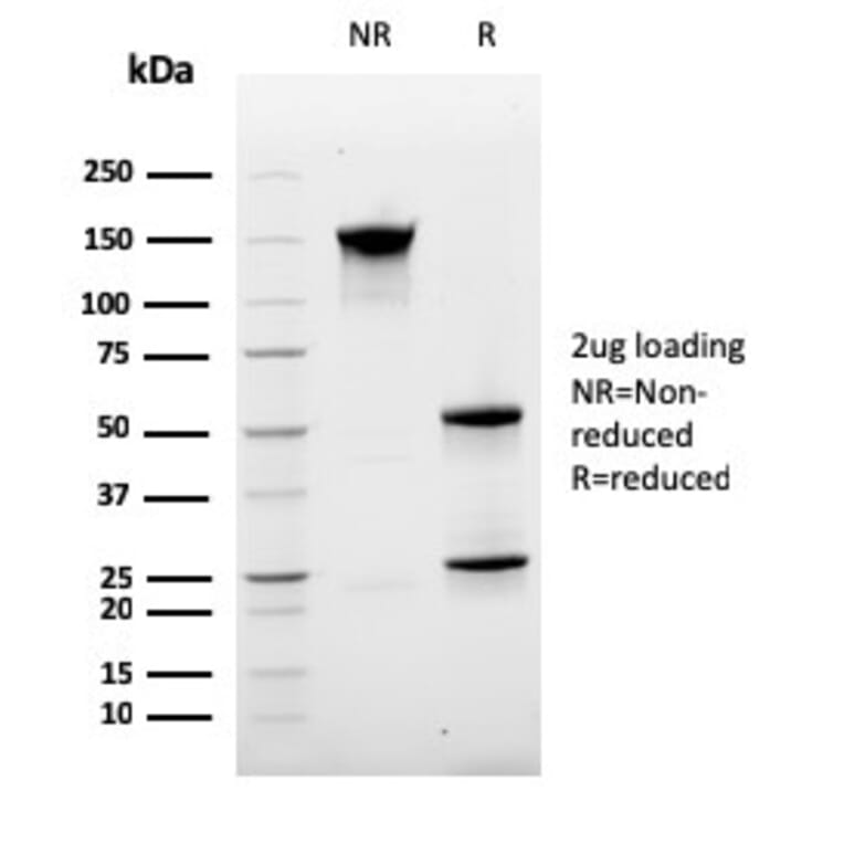 SDS-PAGE - Anti-Ki67 Antibody [MKI67/2463] (A249346) - Antibodies.com