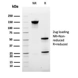 SDS-PAGE - Anti-Ki67 Antibody [MKI67/2463] (A249346) - Antibodies.com